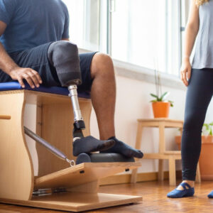 Supporting NDIS Participants with Amputation